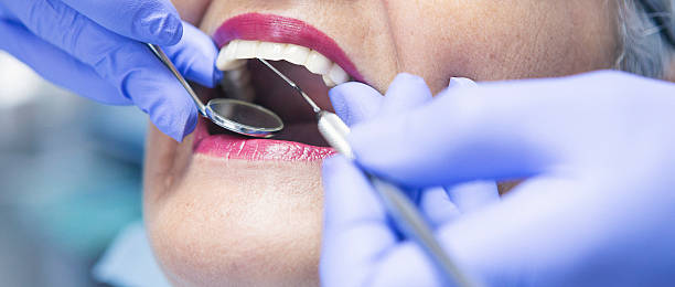 Best Emergency Wisdom Teeth Removal in Oak Grove, TN